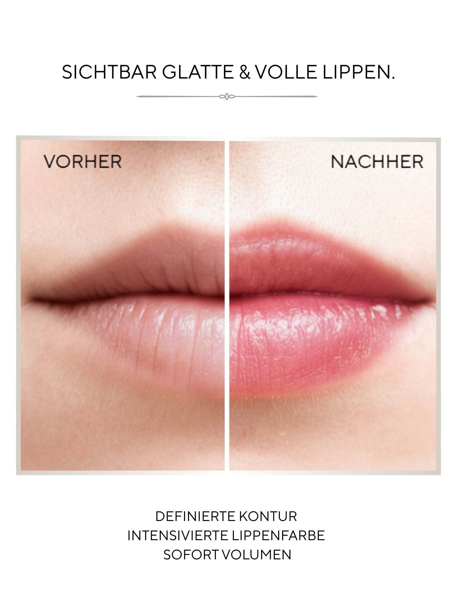 Firming Lip Volumizer MD